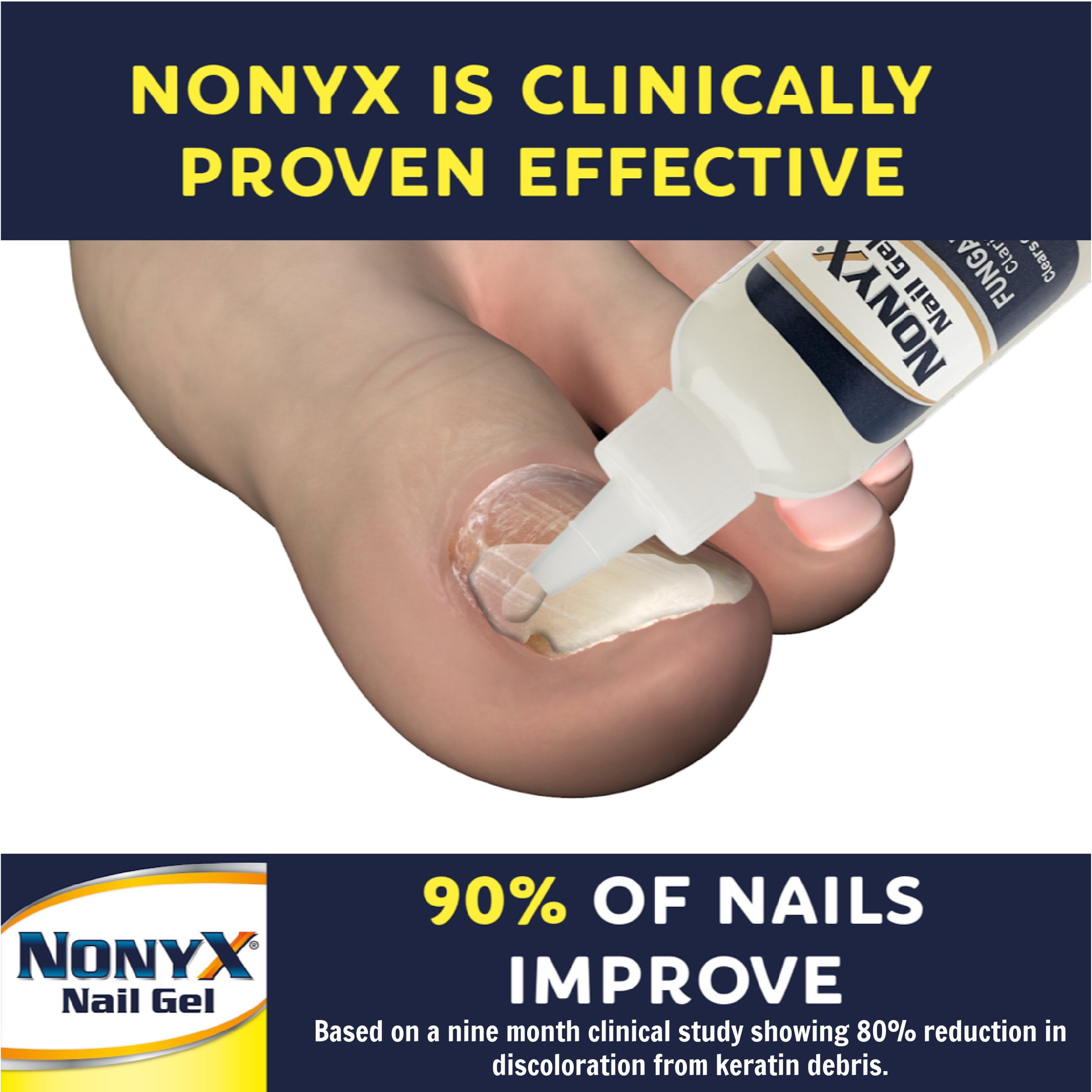NonyX Fungal Nail Clarifying Gel, 4 oz