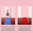 thumbnail image 4 of Zing Point Portable H Removal Instrument Home Electric Shaver, 4 of 4