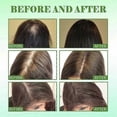 thumbnail image 5 of Rosemary Mint Scalp Hair Growth Essential Oil Nourishing Hair Strengthening Treatment For Split Ends And Dry Hair, 5 of 5