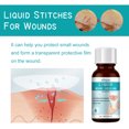thumbnail image 2 of Wound Repair Solution For Redness, Swelling And Discomfort Of The Skin, 2 of 5
