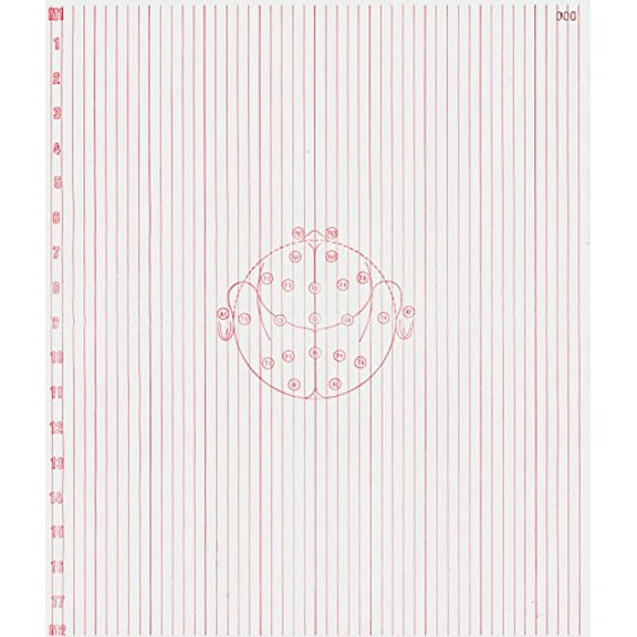 EEG Paper for Nicolet 1A97 (345MM X 300 MM X 1000 Sheets 6MM RED Channels) 220-703400 (2)