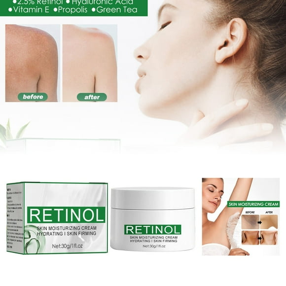 VOKE Lanolin Self Harm Pregnancy Stretch Marks Prevention Hand Food Mens Birthday Beauty Fade Dark Skin On Joints Underarms Brighten Complexion Hydrate And Moisturize Body Lotion !