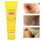 thumbnail image 5 of Crema para Aclarar las Axilas LYUMO Hidratante Correctora de Manchas Oscuras 50g, 5 of 8