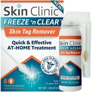 Skin Clinic FREEZE 'n CLEAR Skin Tag Remover