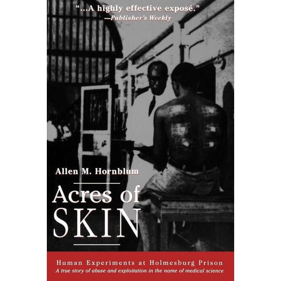 Acres of Skin: Human Experiments at Holmesburg Prison, (Paperback)