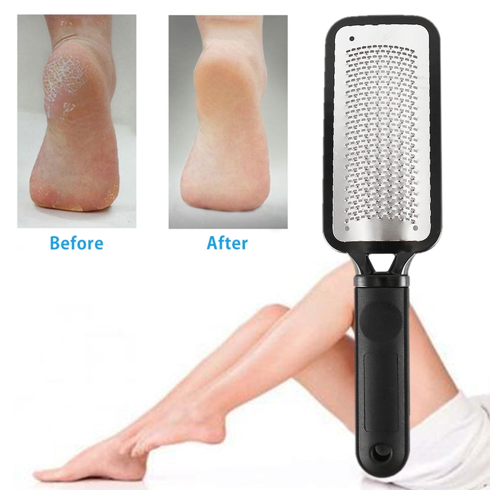 Foot File Callus Remover Feet Rasp for Dead Skin Foot Scrubber for Feet 6  Pcs - 6PCS white collar blue 
