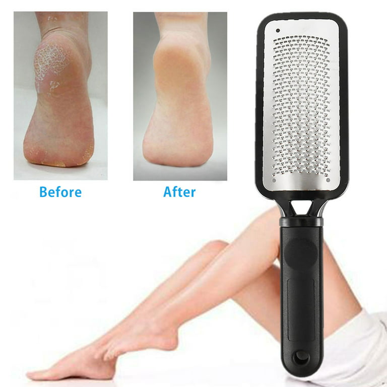 Foot File Foot Scrubber Pedicure - Callus Remover for Feet Easkep  Professional Foot Grater Rasp Foot Scraper Corns Callous Removers Dry skin  Cracked Dead Skin Remover for Dry and Wet Feet (Golden)