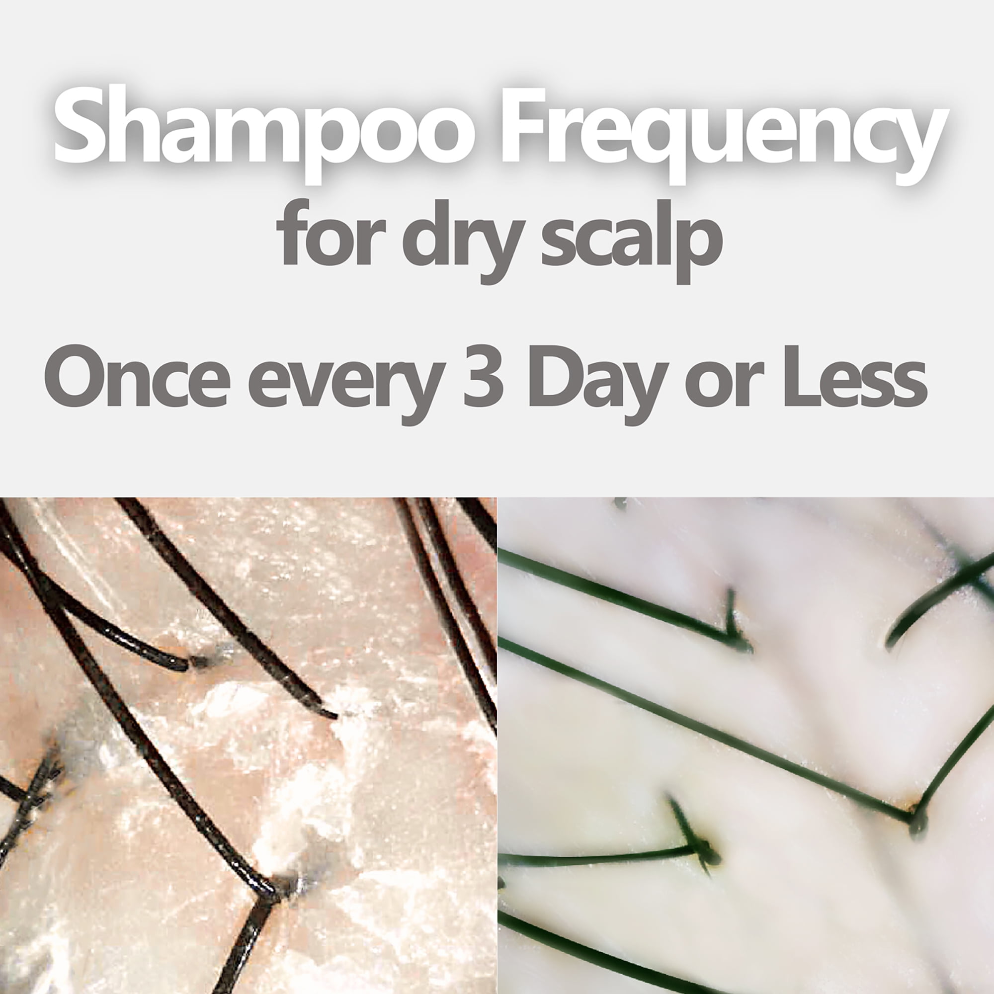 Aromase Dry Scalp Soothing Shampoo, Moisturizing Shampoo, 14 oz