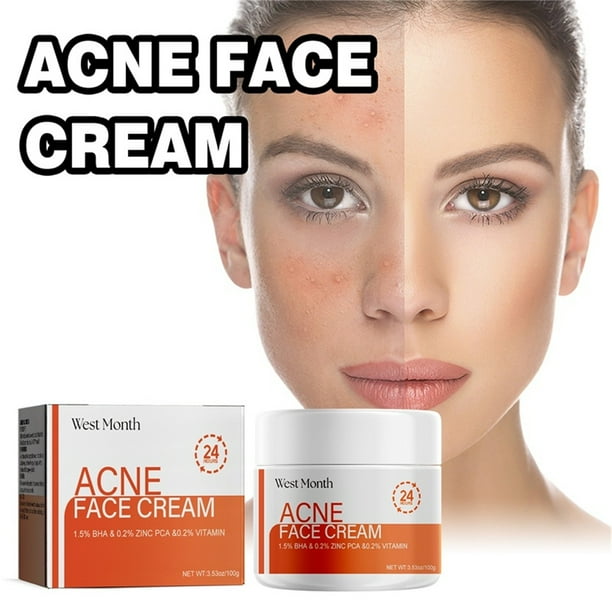 Crema Facial Salicílica para Piel con Tendencia Acneica | Hidratante Facial y Corporal | Tratamiento para El Acné Hormonal Quístico | Ingredientes Naturales | Incluye Mascarilla de 100 G