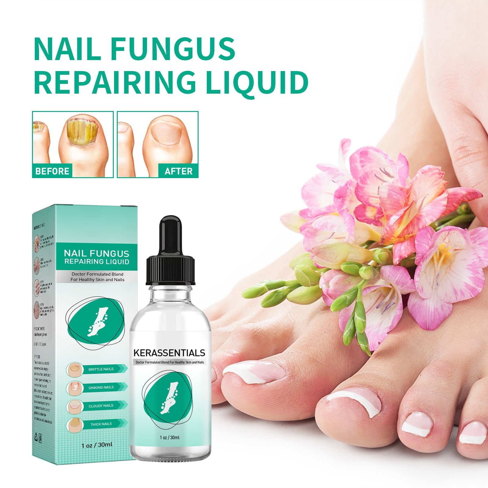 Kerassentials Toenail Treatment Oil, Kerasentials Toenail Nail Treatment for Damaged and Discolored Nails, Nail Treatment Drop For Fungal Infections(3 pcs)