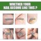 thumbnail image 5 of 2pcs South Moon Nail Care Roller Balls - Nourishing Massage For Stronger, Faster-growing Nails With 7-day Nail Growth Formula, 5 of 5