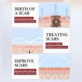 thumbnail image 4 of Scars Repair Cream Effective Acnes Scars Removal Cream for Women Men, 4 of 5