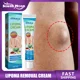 thumbnail image 2 of Crema de eliminación de labios para aliviar el dolor, tratamiento de la hinchazón de la piel, lipólisis, celulitis, manchas de grasa, pomada de eliminación de nódulos, yeso antitumoral, 2 of 5