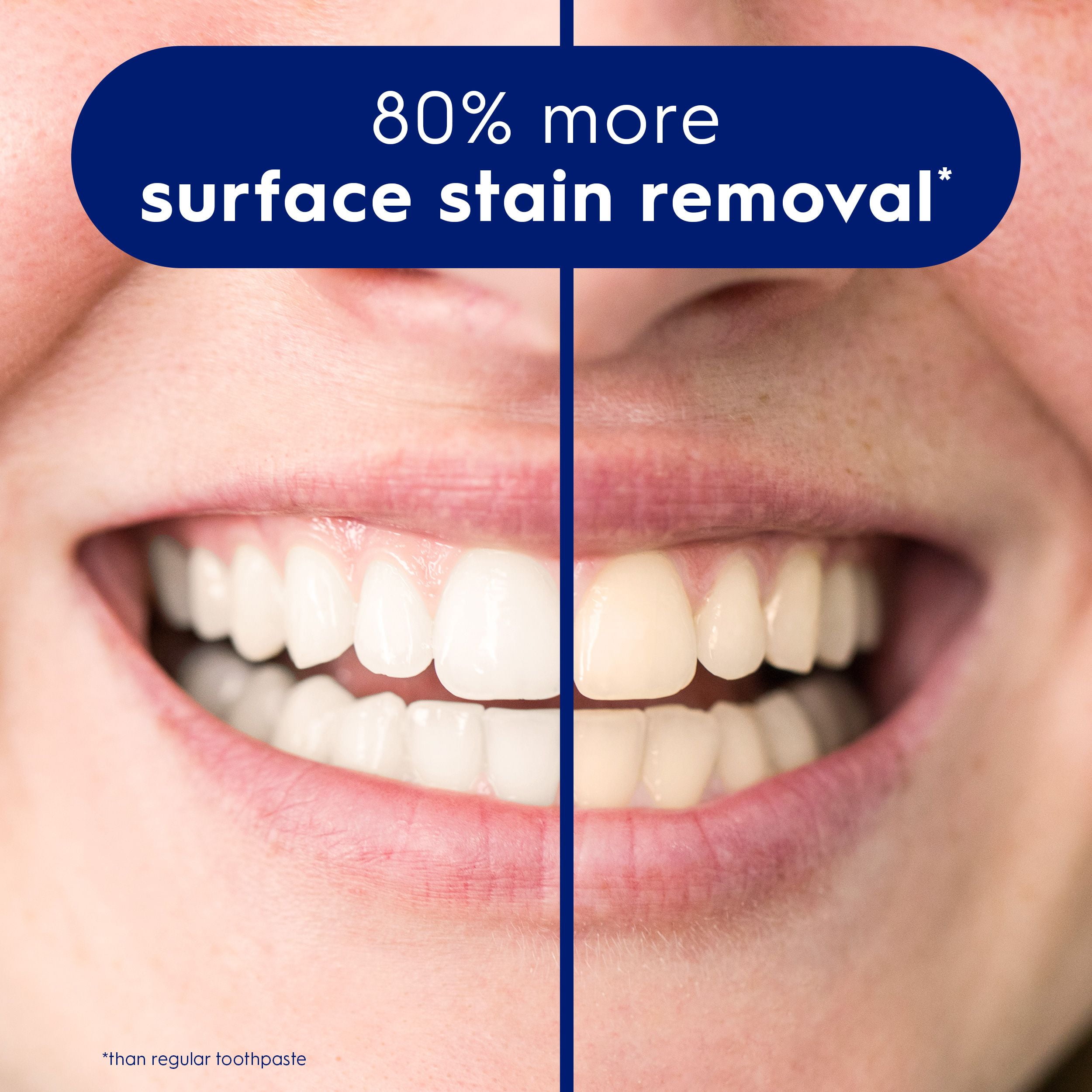 Crest 3D White Stain Eraser Teeth Whitening Toothpaste, Polishing Mint, 65 mL