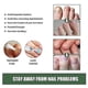thumbnail image 4 of 1/3 Uds. Tratamiento antihongos, onicomicosis, tratamiento de hongos paroniquia, lápiz de aceite para uñas, removedor de uñas antimicótico, 4 of 5