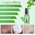 thumbnail image 4 of high qualityBlackhead Remover Serum With 100 Strips, Blackhead Remover Mask Peel Off Blackhead Mask 2 in 1 Green Tea Oil Blackhead Removal, 4 of 5