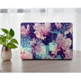 thumbnail image 5 of Plastic Protective Case Hard Cover for 2012 - 2015 Released MacBook Pro 15" No Touch Cable Tie Model: A1398 Marble A 209, 5 of 5