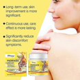 thumbnail image 4 of Psoriasis Cream, Skin Relief Anti-itch Cream Psoriasis Cream, Safe & Effective, Natural Herbal Skin Soothing Cream, 4 of 4