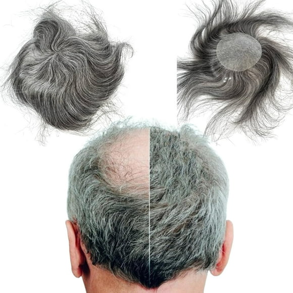 Voloria Bald Spot Hair Patch Toupee For Men 3.15X3.15Inches Full Pu Skin Base Cover-Up Hair Patches Pieces Human Hair Topper Reaplcement Systems Hairpiece (1B Black Mixed 60% Grey Color)