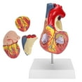 thumbnail image 1 of Heart Organ Model, Heart Model 49 Parts  For Teaching Use, 1 of 8