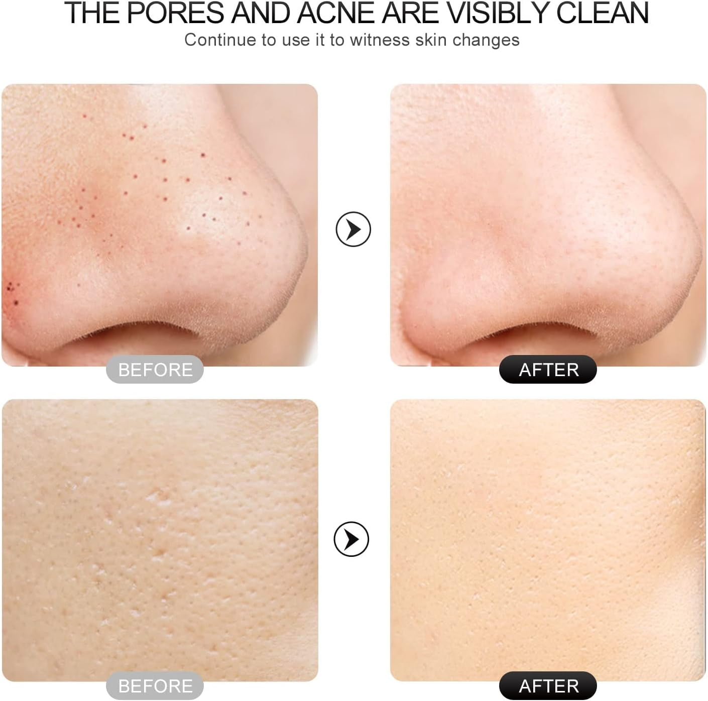 NOBRAND 4 Modes Facial Skin Scrubber & Blackhead Remover