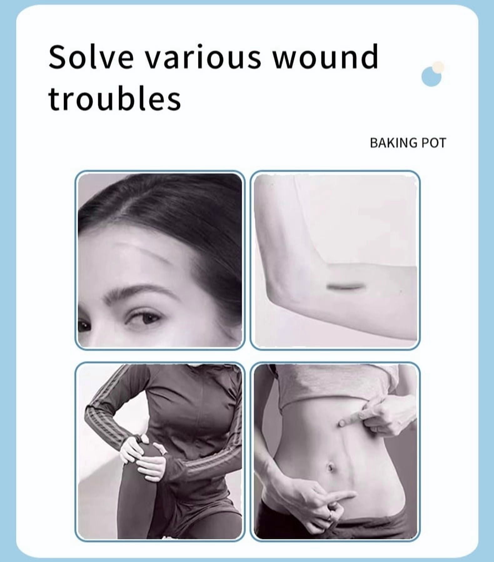 Wound Closure Strips for Emergency First Aid, Butterfly Bandages Suture Alternative, Surgical Laceration Repair Without Stitches or Needles (4 Pack)