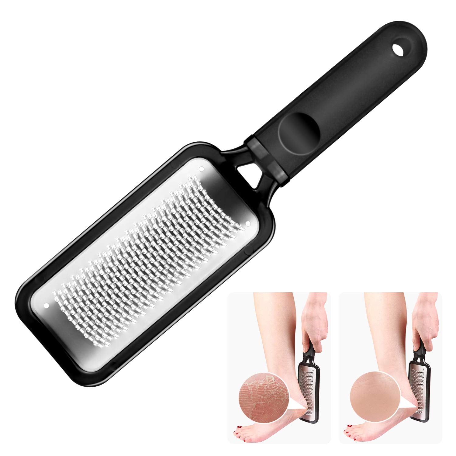 DYNESSE Foot File. Best Premium Pedicure Foot Rasp and Callus Remover.  3-in-1 Tool. Removes Hard Skin. No Risk of Injury. Stainless Steel.  Ergonomic
