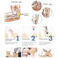 thumbnail image 4 of Máquina de terapia de ondas de choque, masajeador corporal Nulatool, 4 of 6