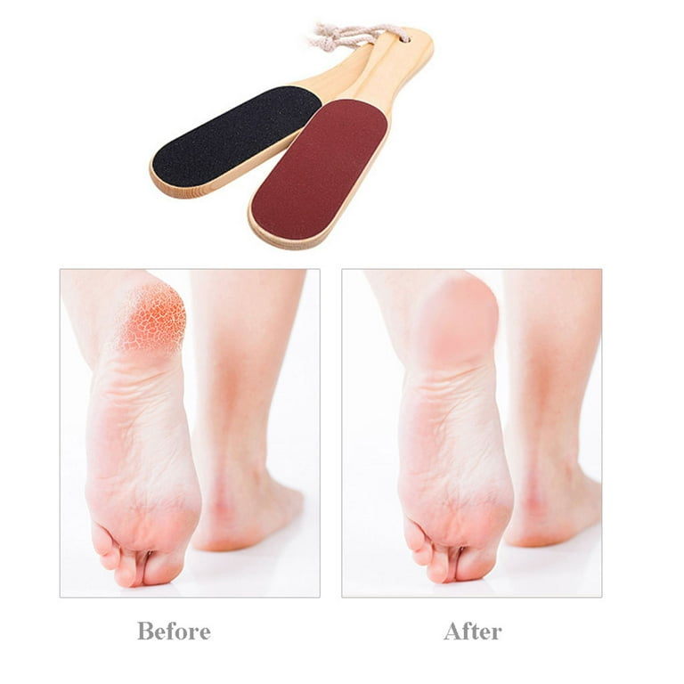 HOMEIU Heel Scraper For Feet Shower Callus Remover for Feet To Remove Dead  Skin Hard Skin Cracked Heels Perfect Foot Care