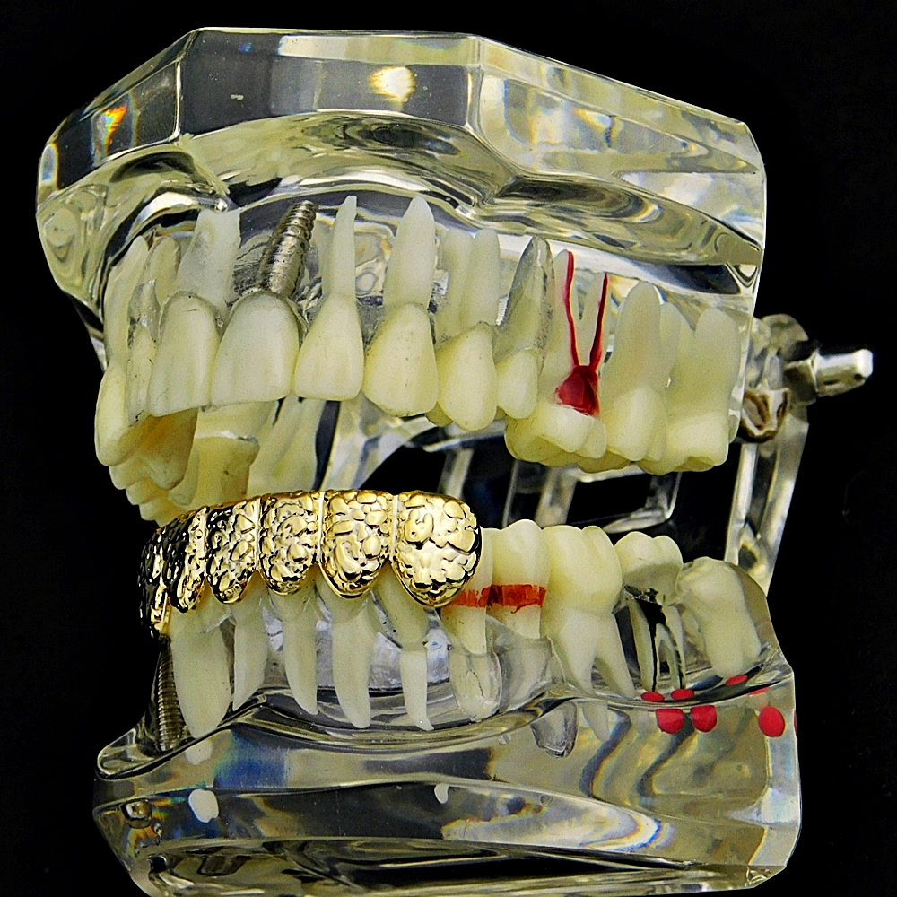 14k Gold Plated Small Single Tooth Cap Grillz – Hip Hop Jewelry For Teeth (Gold/Silver)