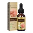 thumbnail image 1 of Psoriasis Dandruff Treatment for Scalp, Anti Itching Follicle Booster Stimulator Smoothing Nourishing Hair Serum, 1 of 5