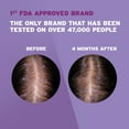 thumbnail image 4 of Women's Rogaine 2% Minoxidil Liquid Solution, 3-Month Supply, 4 of 7