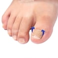 thumbnail image 3 of 100 parches correctores para uñas de los pies, sin pegamento, para pedicura, corrector para uñas encarnadas., 3 of 3