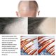 thumbnail image 4 of Jaysuing Of Hair Care Liquid Strong Hair To Prevent Hair Root Massage Nourishing Liquid Thick Scalp, 4 of 4