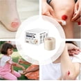 thumbnail image 4 of Hydrocolloid Roll 8x8x6cm Large Waterproof Pimple Patches Flexible Absorbent Invisible Tape for Blister Burn Skin, 4 of 5