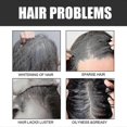 thumbnail image 2 of OUHOE Black Hair Soap Repair Black Hair Solid Hair Massage Moisturizing Hair Black Hair Soap Black Hair Clea, 2 of 4