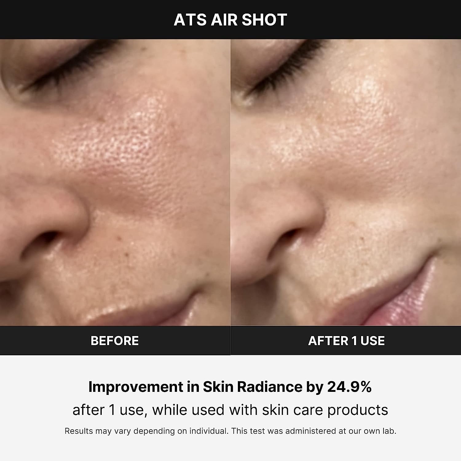 Medicube Age-R ATS Air Shot - Microneedling Pore Tightening Skin Care  Device for Enhanced Absorption, Pore Refinement, and Smoother Skin Texture