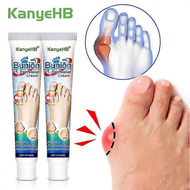 ZHAOCHENG piezas de crema para aliviar el dolor de juanetes, ungüento médico para la articulación del dedo gordo del pie, tratamiento de la periostitis del dedo gordo del pie, gota, dolor de pies, yes