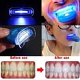 thumbnail image 4 of Blanqueador de dientes azul, luz cosmética, aparatos blanqueadores de dientes, blanqueador de dientes portátil para el hogar, cuidado bucal, Blu-ray saludable, 4 of 5