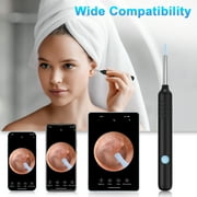 Ear Wax Removal,NEXPURE Ear Cleaner with 1080P HD Camera , Wirless Otoscope with 7 Pieces Set for Ear Cleaning