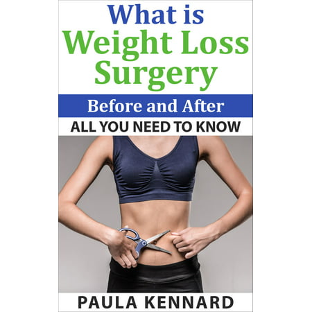 What Is Weight Loss Surgery: All You Need To Know Before And After - (Best Before And After Weight Loss)