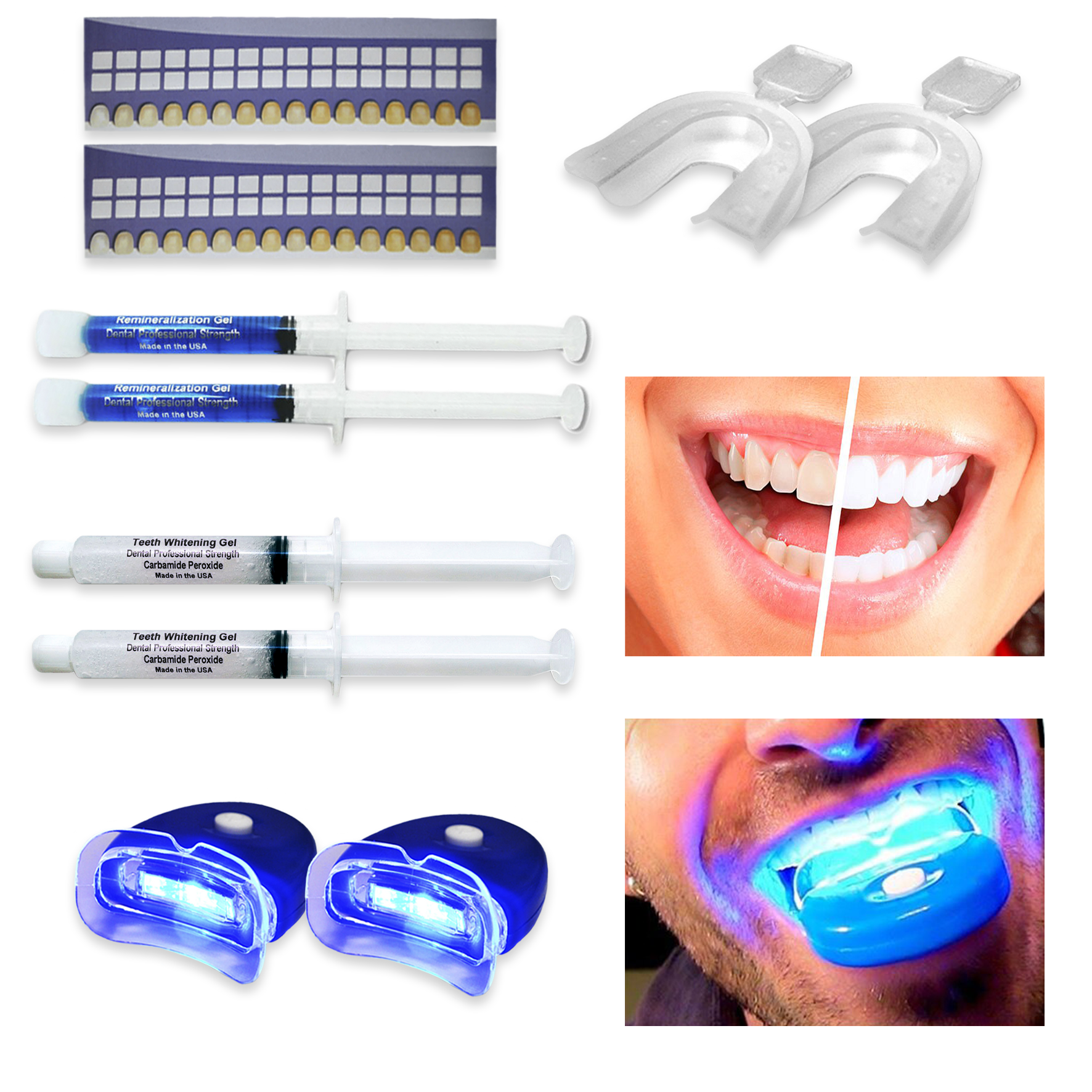 Always White Premium Teeth Whitening Kit for Two - 35% Whitening Gel Syringes - Made in USA