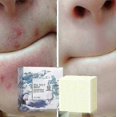 thumbnail image 2 of Anti Fungal Skin Soap Anti-mite Soap Handmade Soap Sea Salt Soap Antimite Oil-control And Firming Skin, 2 of 2