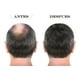 thumbnail image 4 of Kit Estimulador Crecimiento De Cabello Unisex The Shaving Co, 4 of 10