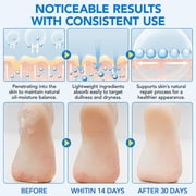 Uruses Urea Foot Care Stick for Dry Cracked Heels, 60% Urea Cream Moisturizing Balm for Feet, 1.41 oz