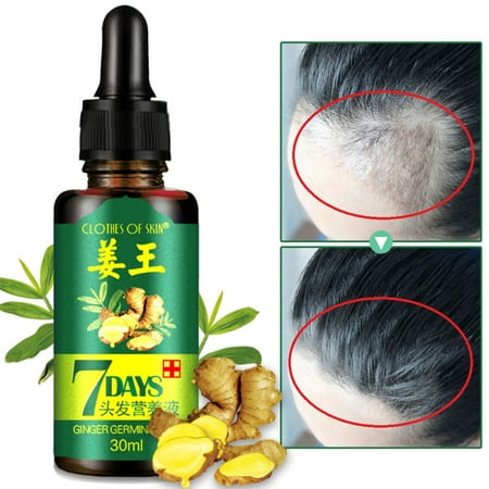 30ML Ginger Hair Growth Serum Hair Loss Treatment Care For Men And