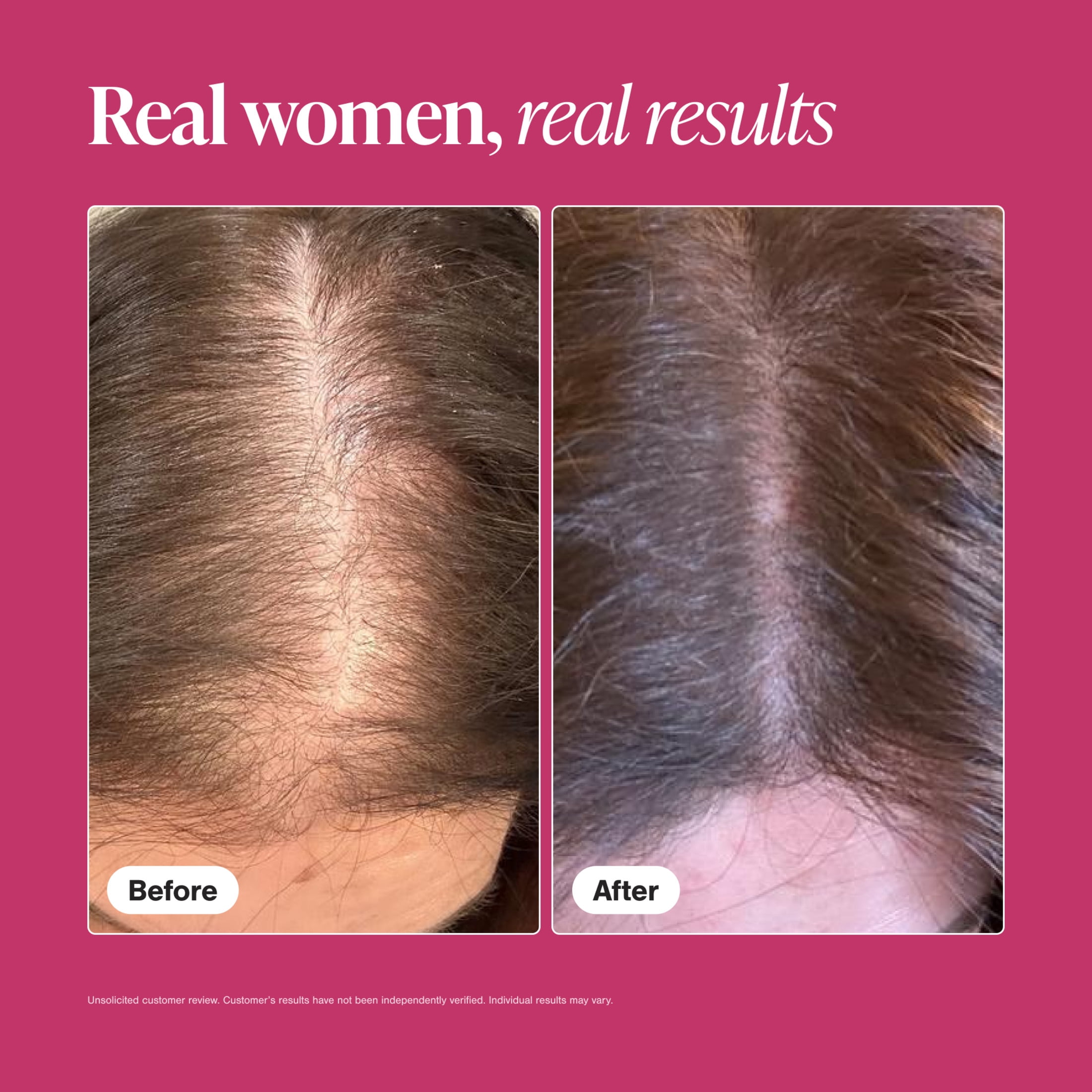 Viviscal Hair Growth Supplements for Women, Thicker Fuller Hair Support for Thinning Hair and Hair Loss, with Biotin and Marine Collagen, Drug-Free, 60 Tablets, 1-Month Supply