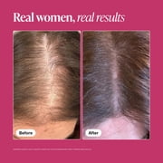 Viviscal Hair Growth Supplements for Women, Thicker Fuller Hair Support for Thinning Hair and Hair Loss, with Biotin and Marine Collagen, Drug-Free, 60 Tablets, 1-Month Supply