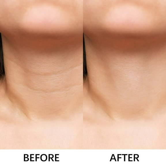Rewenti Tightening Neck Texture Patch Lifting and Firming Neck Care Weakening Neck Texture Cream 150g
