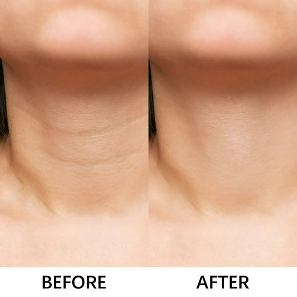 Parche texturizante para el cuello, reafirmante y tensor, crema para el cuello debilitado (150 g)